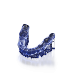 SprintRay Night Guard Firm 2